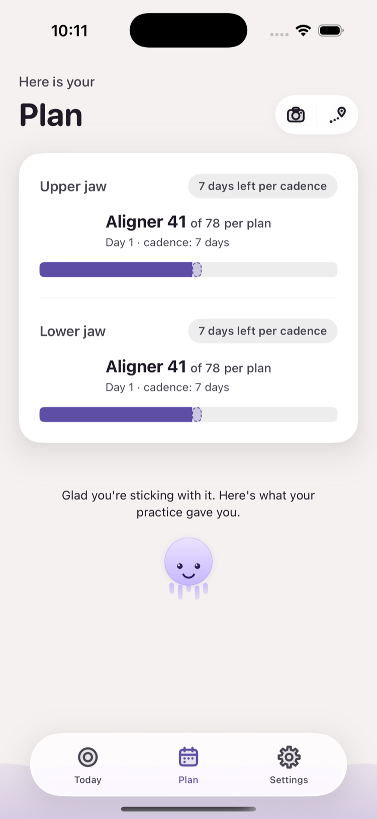 Milo Plan — aligners for upper and lower jaw