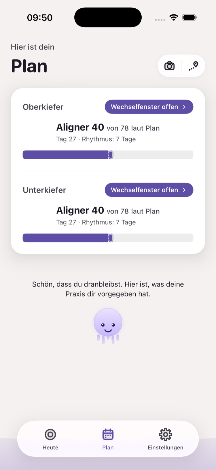 Milo Plan – Aligner für Ober- und Unterkiefer